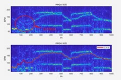 基于大數據與深度學習的穿戴式運動心率算法