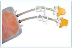 行業首創解決方案徹底改變了 CGT 無菌工藝