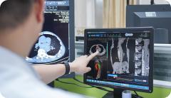 全球首款：浙大一院、阿里達摩院發布主動脈急診 AI 模型，快速識別“最兇險胸痛”